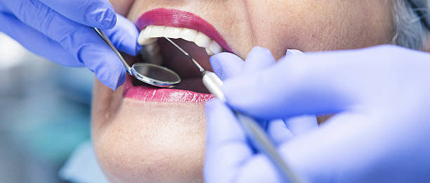 Best Emergency Root Canal Treatment in Stillwater, MN